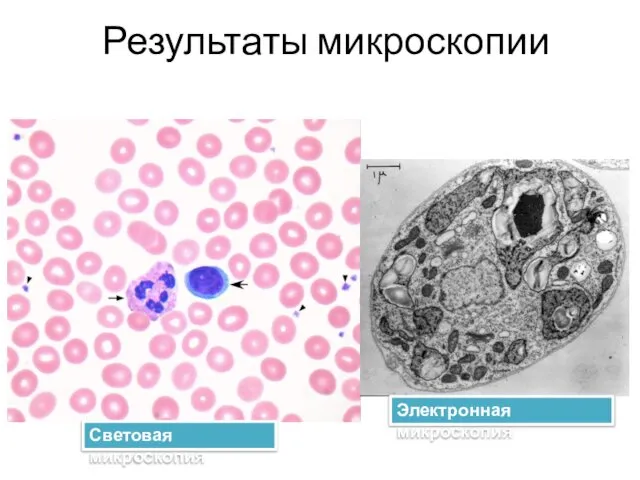 Результаты микроскопии Световая микроскопия Электронная микроскопия