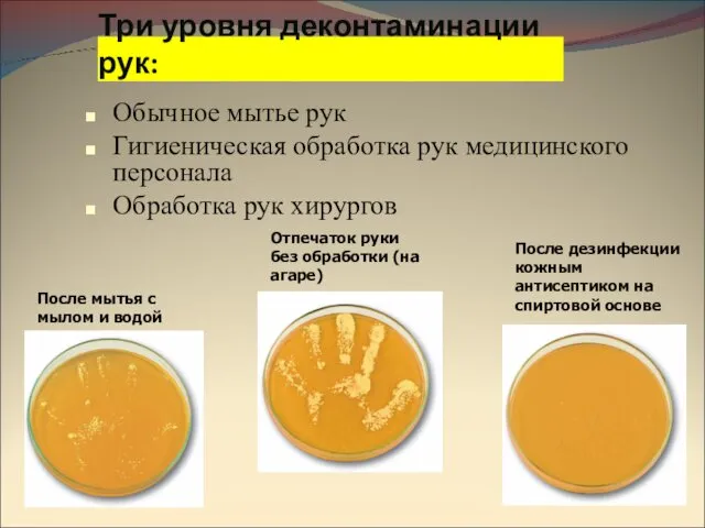 Обычное мытье рук Гигиеническая обработка рук медицинского персонала Обработка рук хирургов