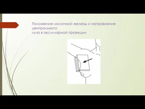 Положение молочной железы и направление центрального луча в аксиллярной проекции