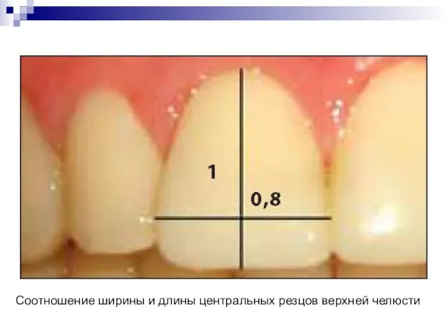 Соотношение ширины и длины центральных резцов верхней челюсти