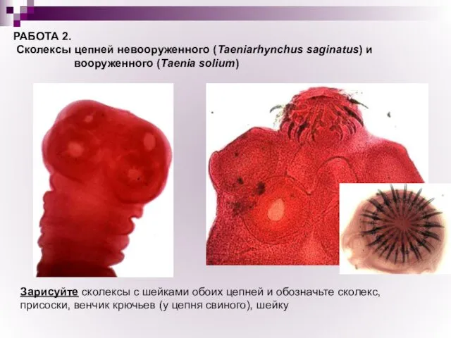 РАБОТА 2. Сколексы цепней невооруженного (Taeniarhynchus saginatus) и вооруженного (Taenia solium)