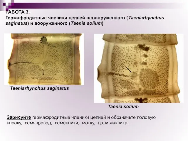 РАБОТА 3. Гермафродитные членики цепней невооруженного (Taeniarhynchus saginatus) и вооруженного (Taenia