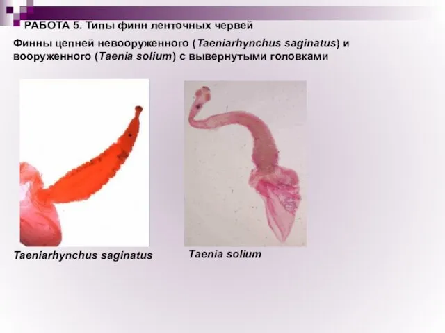 РАБОТА 5. Типы финн ленточных червей Финны цепней невооруженного (Taeniarhynchus saginatus)