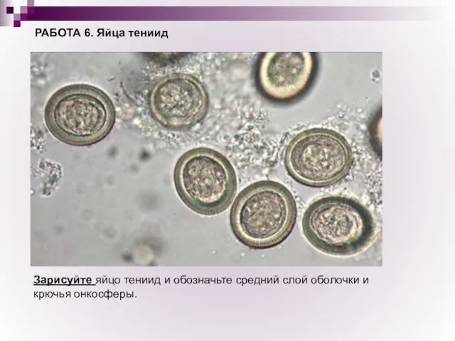 РАБОТА 6. Яйца тениид Зарисуйте яйцо тениид и обозначьте средний слой оболочки и крючья онкосферы.