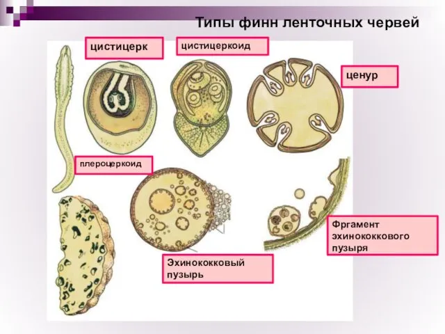 Типы финн ленточных червей цистицерк цистицеркоид ценур плероцеркоид Эхинококковый пузырь Фргамент эхинококкового пузыря