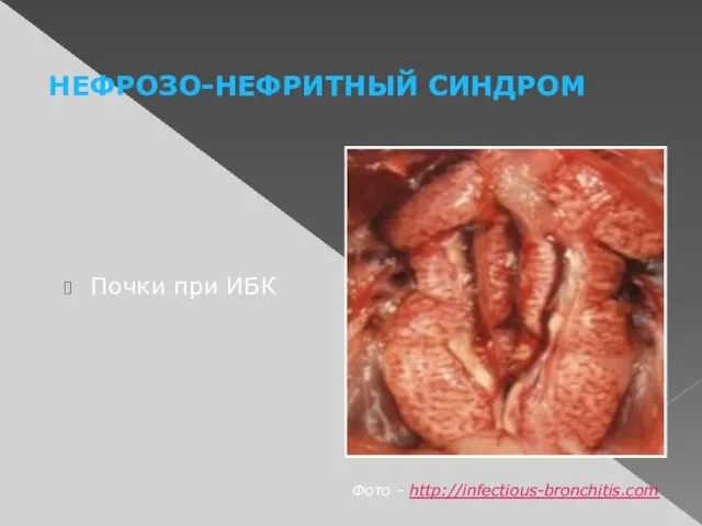 НЕФРОЗО-НЕФРИТНЫЙ СИНДРОМ Фото - http://infectious-bronchitis.com Почки при ИБК