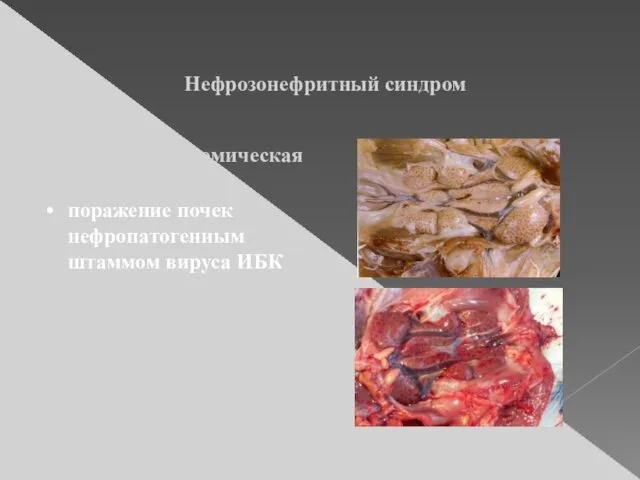 Нефрозонефритный синдром Патологоанатомическая картина поражение почек нефропатогенным штаммом вируса ИБК