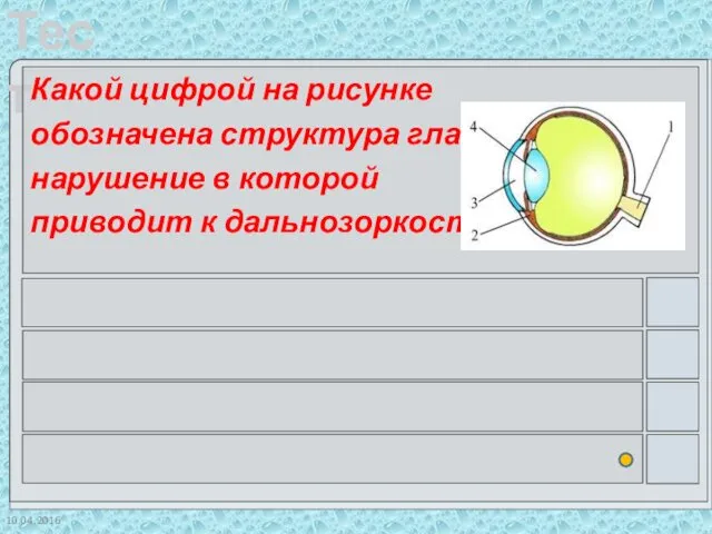 10.04.2016 Какой цифрой на рисунке обозначена структура глаза, нарушение в которой приводит к дальнозоркости?