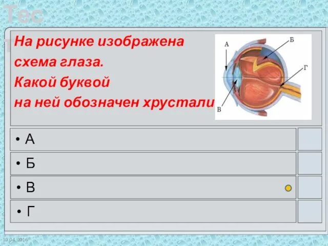 10.04.2016 На рисунке изображена схема глаза. Какой буквой на ней обозначен хрусталик? А Б В Г