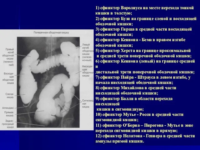 1) сфинктер Варолиуса на месте перехода тонкой кишки в толстую; 2)