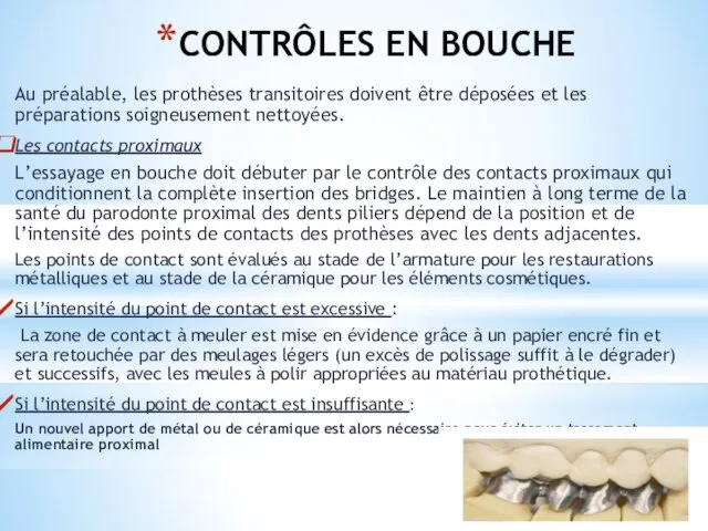 CONTRÔLES EN BOUCHE Au préalable, les prothèses transitoires doivent être déposées