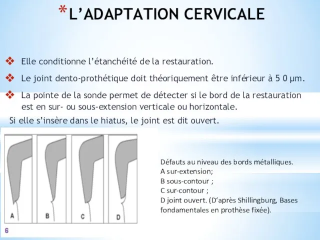 L’ADAPTATION CERVICALE Elle conditionne l’étanchéité de la restauration. Le joint dento-prothétique