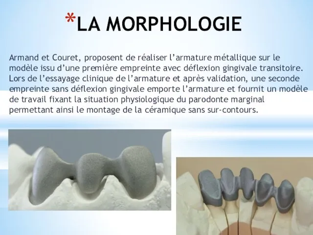 LA MORPHOLOGIE Armand et Couret, proposent de réaliser l’armature métallique sur