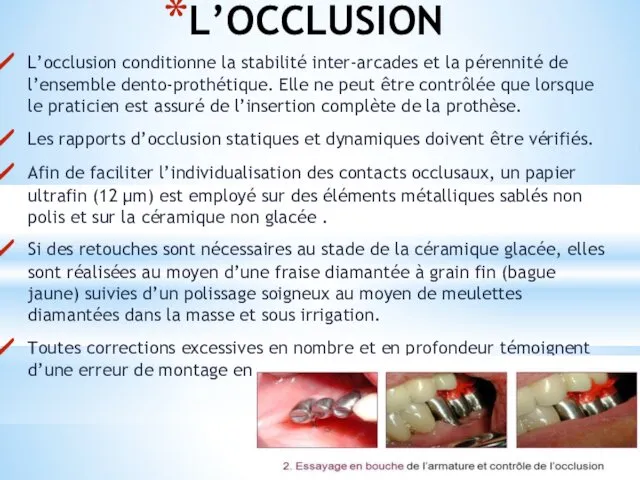 L’OCCLUSION L’occlusion conditionne la stabilité inter-arcades et la pérennité de l’ensemble