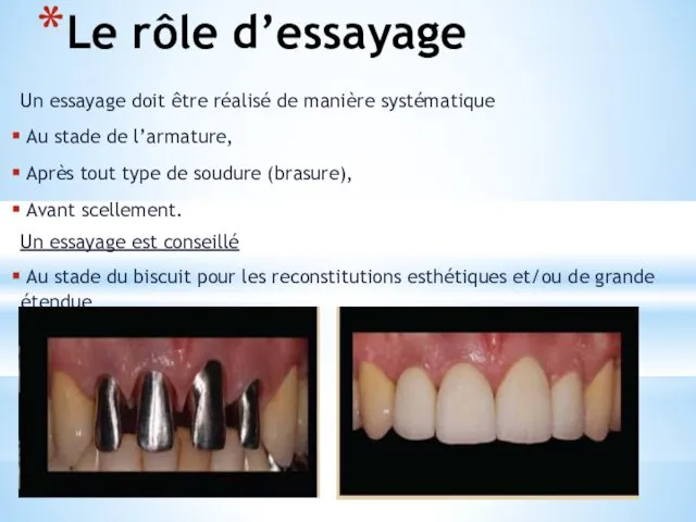 Le rôle d’essayage Un essayage doit être réalisé de manière systématique