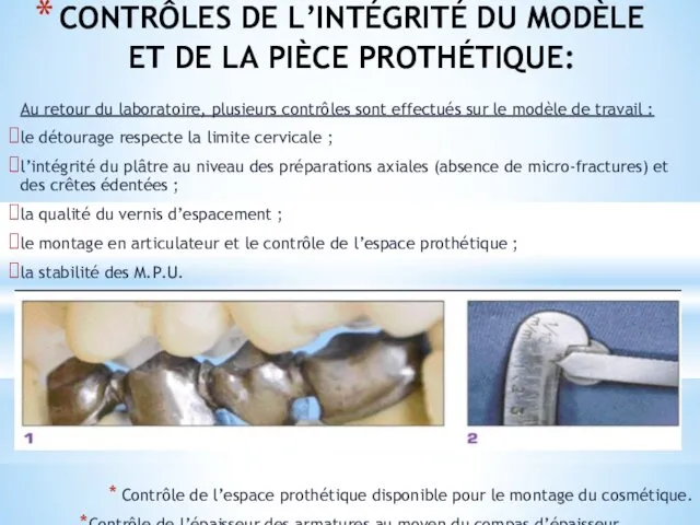 CONTRÔLES DE L’INTÉGRITÉ DU MODÈLE ET DE LA PIÈCE PROTHÉTIQUE: Au