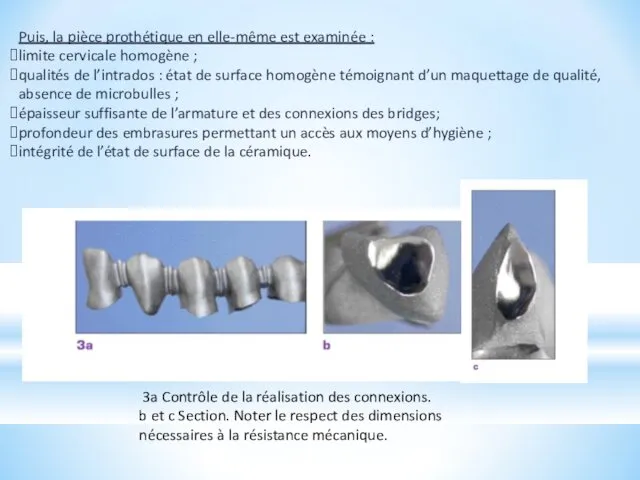 Puis, la pièce prothétique en elle-même est examinée : limite cervicale