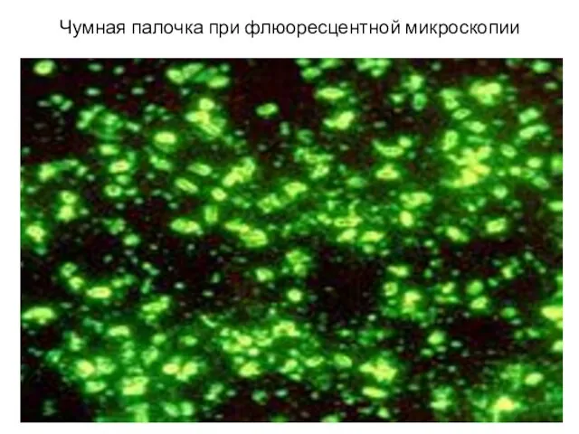 Чумная палочка при флюоресцентной микроскопии