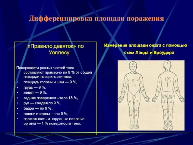 Дифференцировка площади поражения «Правило девяток» по Уоллесу Поверхности разных частей тела