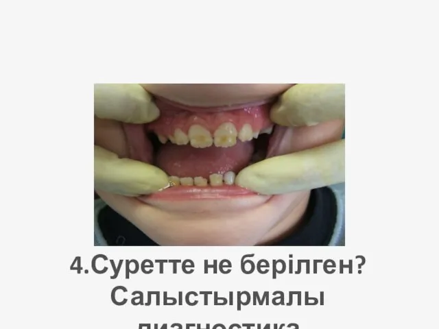 4. 4.Суретте не берілген? Салыстырмалы диагностика