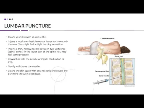 LUMBAR PUNCTURE Cleans your skin with an antiseptic. Injects a local