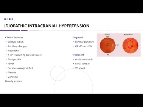 IDIOPATHIC INTRACRANIAL HYPERTENSION Clinical features Change in LOC Pupillary changes Headache