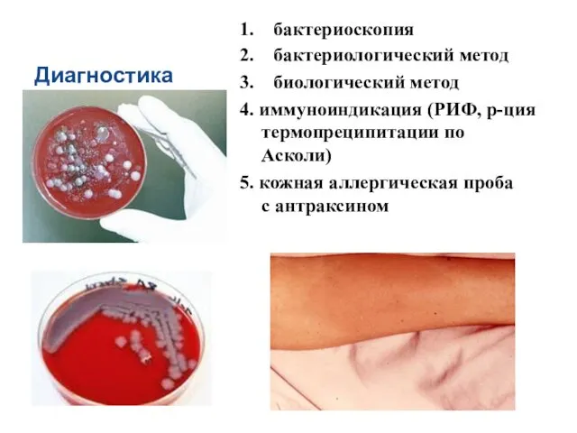 Диагностика 1. бактериоскопия 2. бактериологический метод 3. биологический метод 4. иммуноиндикация