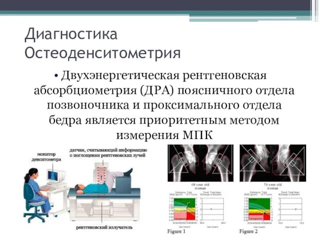 Диагностика Остеоденситометрия Двухэнергетическая рентгеновская абсорбциометрия (ДРА) поясничного отдела позвоночника и проксимального