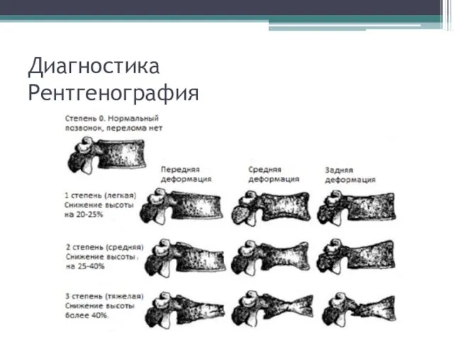 Диагностика Рентгенография