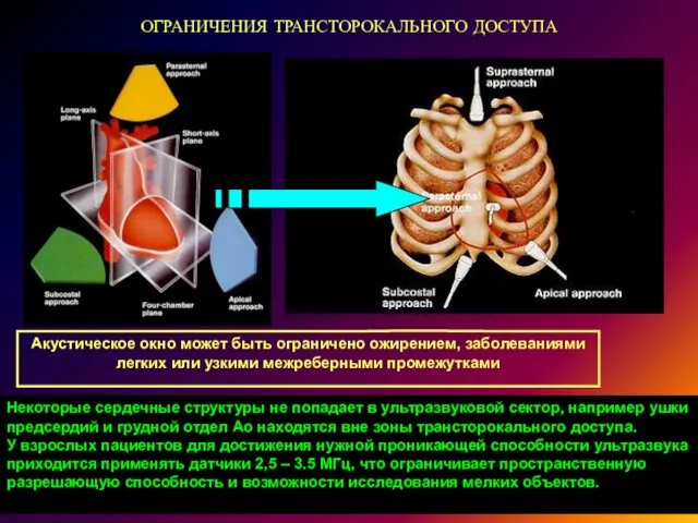 ОГРАНИЧЕНИЯ ТРАНСТОРОКАЛЬНОГО ДОСТУПА Акустическое окно может быть ограничено ожирением, заболеваниями легких