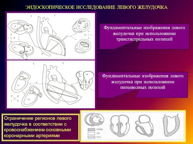 ЭНДОСКОПИЧЕСКОЕ ИССЛЕДОВАНИЕ ЛЕВОГО ЖЕЛУДОЧКА Фундаментальные изображения левого желудочка при использовании трансгастральных