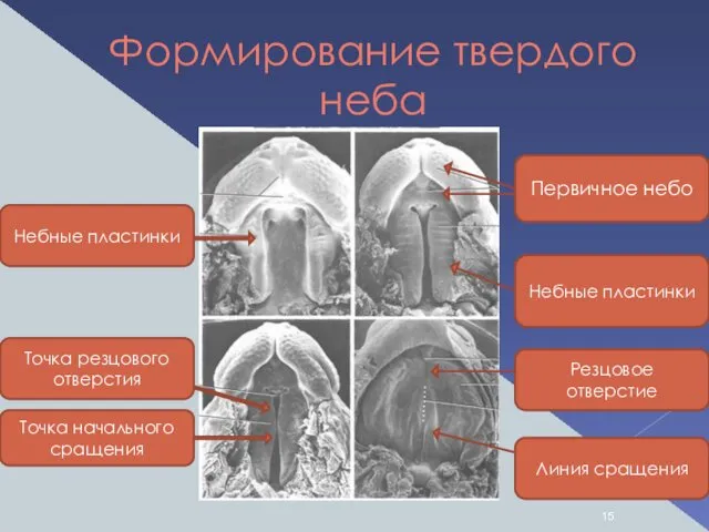 Формирование твердого неба Первичное небо Небные пластинки Резцовое отверстие Линия сращения