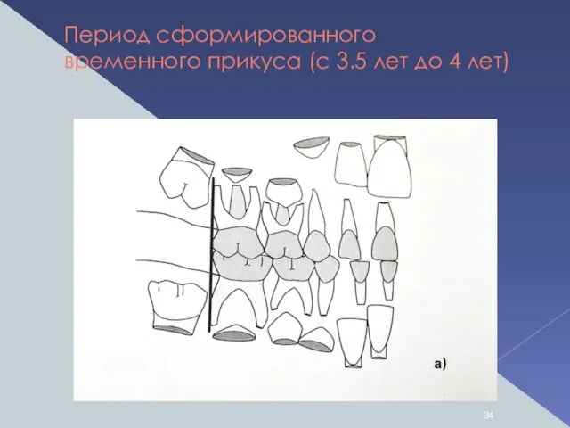 Период сформированного временного прикуса (с 3.5 лет до 4 лет)