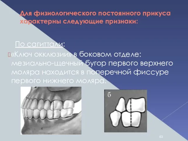 Для физиологического постоянного прикуса характерны следующие признаки: По сагиттали: «Ключ окклюзии»