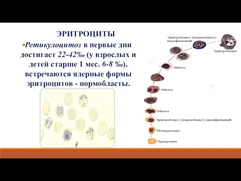 ЭРИТРОЦИТЫ Ретикулоцитоз в первые дни достигает 22-42‰ (у взрослых и детей