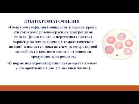 ПОЛИХРОМАТОФИЛИЯ Полихроматофилия (появление в мазках крови клеток кроме розово-красных эритроцитов синего,