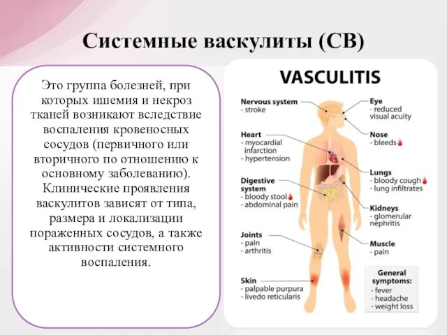 Это группа болезней, при которых ишемия и некроз тканей возникают вследствие