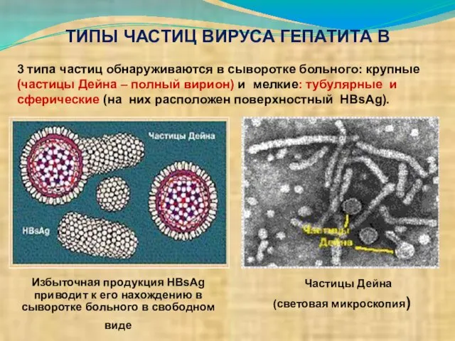 Избыточная продукция HBsAg приводит к его нахождению в сыворотке больного в