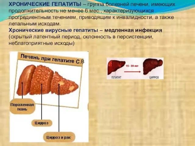 ХРОНИЧЕСКИЕ ГЕПАТИТЫ – группа болезней печени, имеющих продолжительность не менее 6