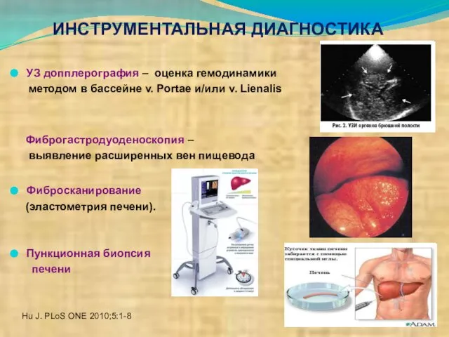 ИНСТРУМЕНТАЛЬНАЯ ДИАГНОСТИКА УЗ допплерография – оценка гемодинамики методом в бассейне v.