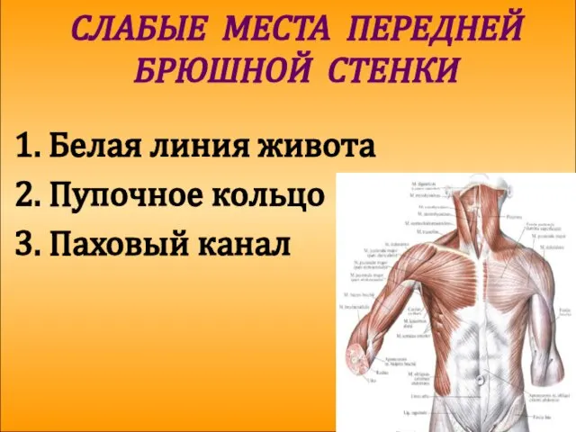 СЛАБЫЕ МЕСТА ПЕРЕДНЕЙ БРЮШНОЙ СТЕНКИ 1. Белая линия живота 2. Пупочное кольцо 3. Паховый канал