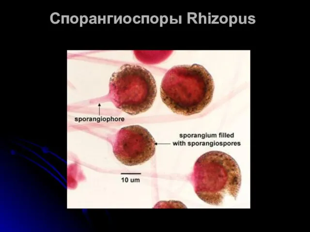 Спорангиоспоры Rhizopus