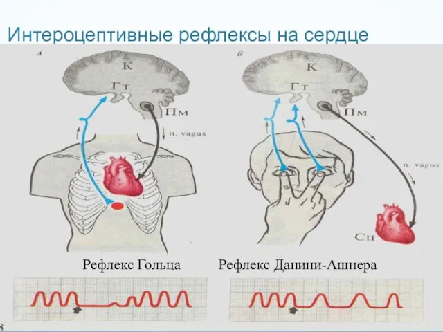 Интероцептивные рефлексы на сердце Рефлекс Гольца Рефлекс Данини-Ашнера