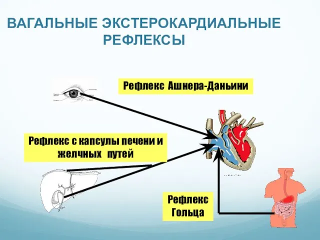 ВАГАЛЬНЫЕ ЭКСТЕРОКАРДИАЛЬНЫЕ РЕФЛЕКСЫ Рефлекс Ашнера-Даньини Рефлекс с капсулы печени и желчных путей Рефлекс Гольца