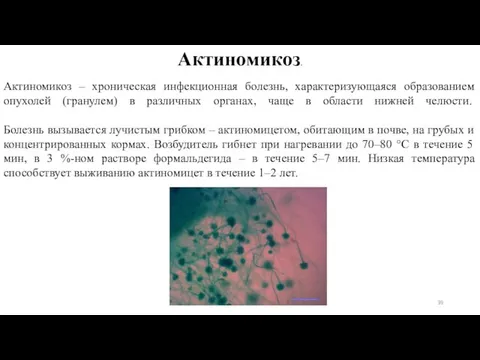 Актиномикоз – хроническая инфекционная болезнь, характеризующаяся образованием опухолей (гранулем) в различных