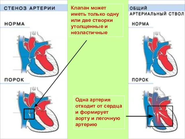 Одна артерия отходит от сердца и формирует аорту и легочную артерию