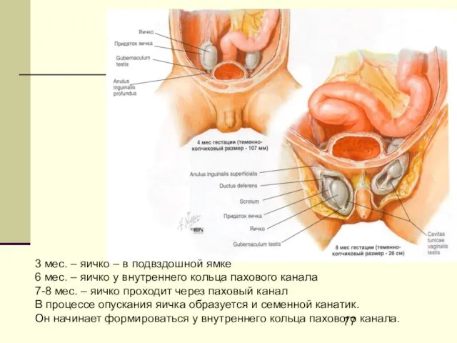 3 мес. – яичко – в подвздошной ямке 6 мес. –