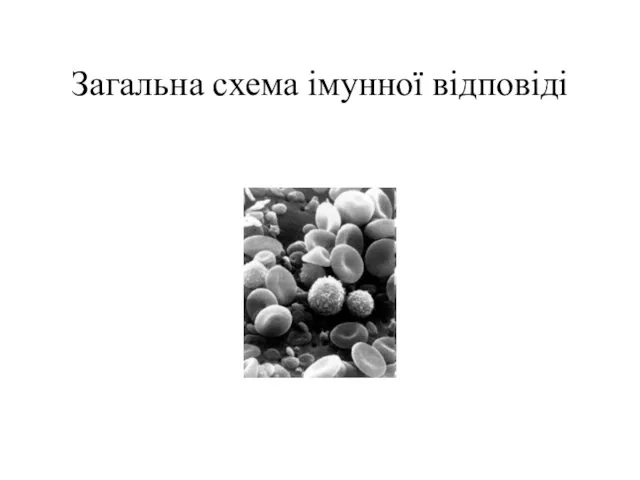 Загальна схема імунної відповіді