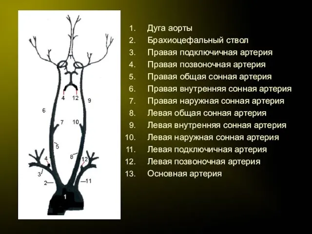 Дуга аорты Брахиоцефальный ствол Правая подключичная артерия Правая позвоночная артерия Правая