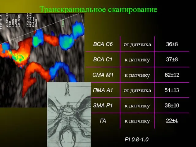 Транскраниальное сканирование PI 0.8-1.0